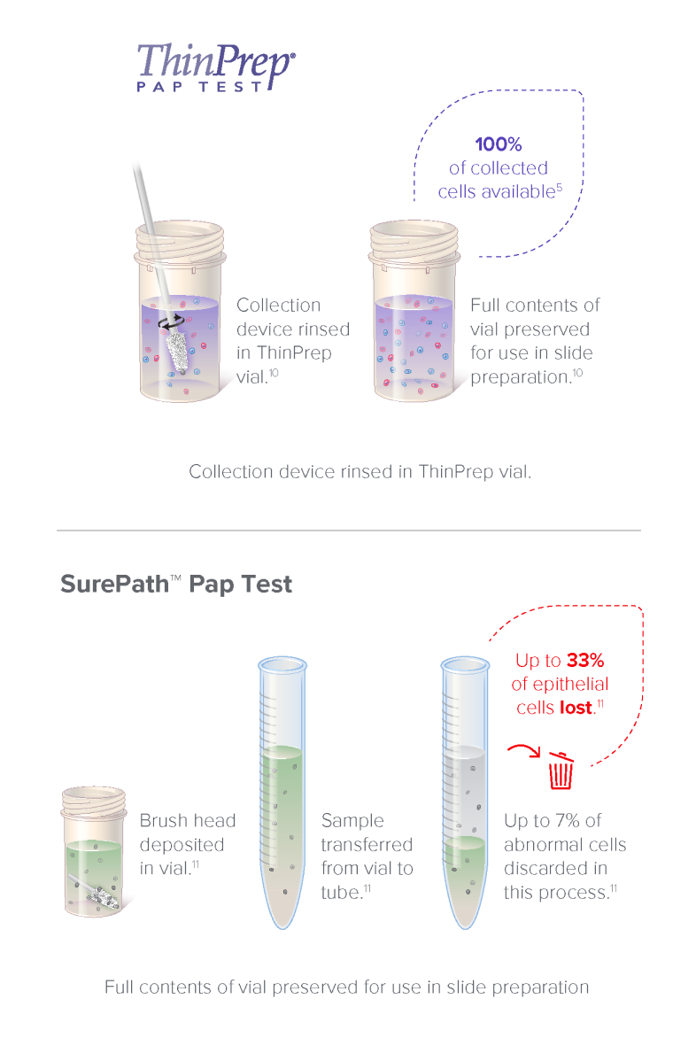 ThinPrep vs Competitor